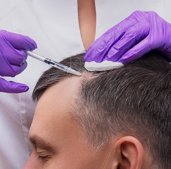Hair loss treatment in Kochi