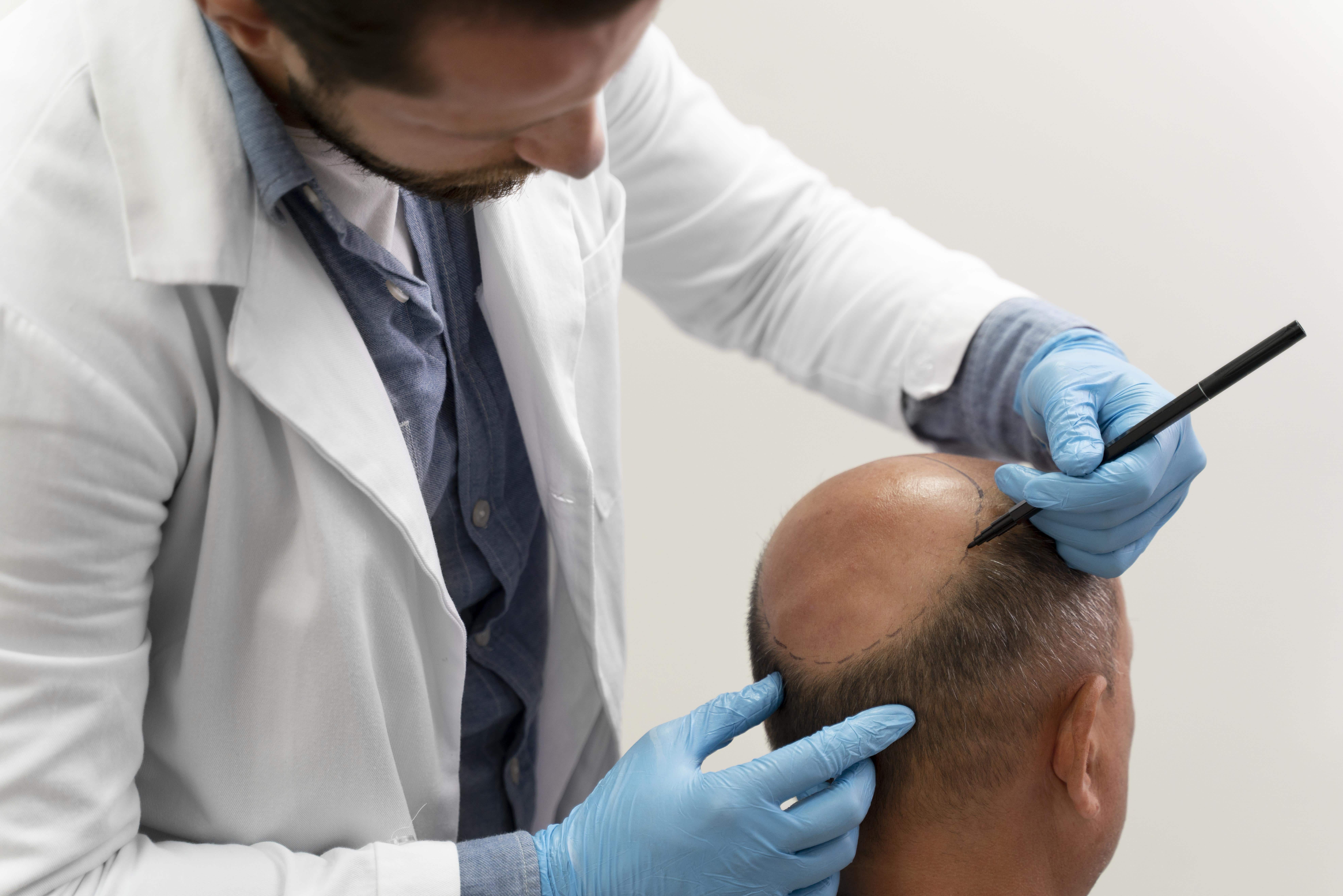 Hair loss treatment in Kochi