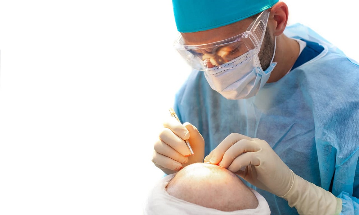 Hair loss treatment