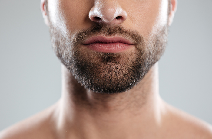 best hair transplantation in Calicut, Kerala