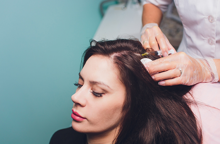 best hair transplantation in Kerala